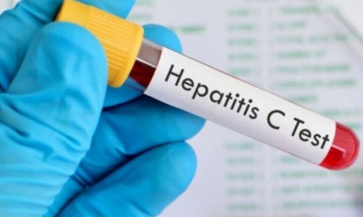 Χιλιάδες νοσούν από ηπατίτιδα C στην Ελλάδα και το αγνοούν 