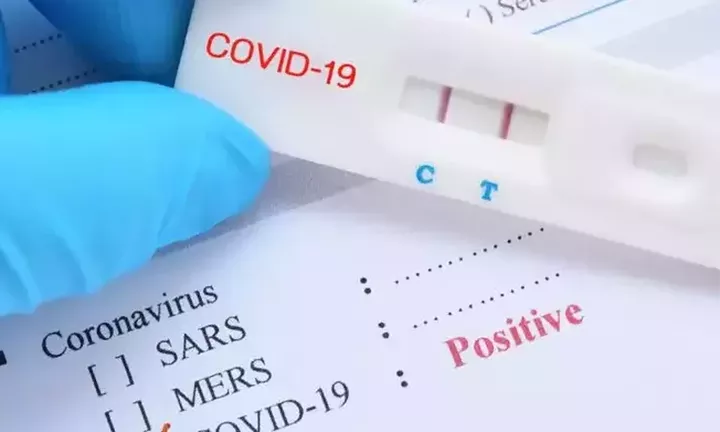 Κοντοζαμάνης: Ζητά τη διανομή self tests από τα φαρμακεία για άλλους 2 μήνες