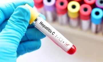  ECDC: Κρούσματα σε παιδιά άγνωστης προέλευσης ηπατίτιδας σε πέντε ευρωπαϊκές χώρες