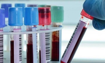 Κλείνουν τα Εργαστήριά τους οι Βιοπαθολόγοι την Πέμπτη, Παρασκευή και Σάββατο