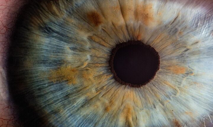 Καταρράκτης: Οι πιθανότητες να γίνει άνοια μια αναστρέψιμη απώλεια όρασης