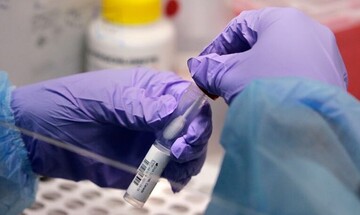 ΕΟΔΥ: Που θα πραγματοποιηθούν δωρεάν rapid test για τον κορωνοϊό το Σάββατο 16 Ιουλίου