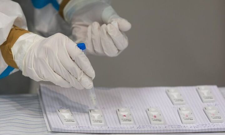 Υπ Υγείας: Με PCR ή Rapid Test η επιστροφή των ανεμβολίαστων υγειονομικών